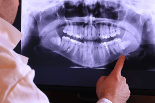 Best Emergency Treatment for Dental Infections or Abscesses in Wolverine Lake, MI